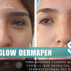 Seminario Dermapen Integral