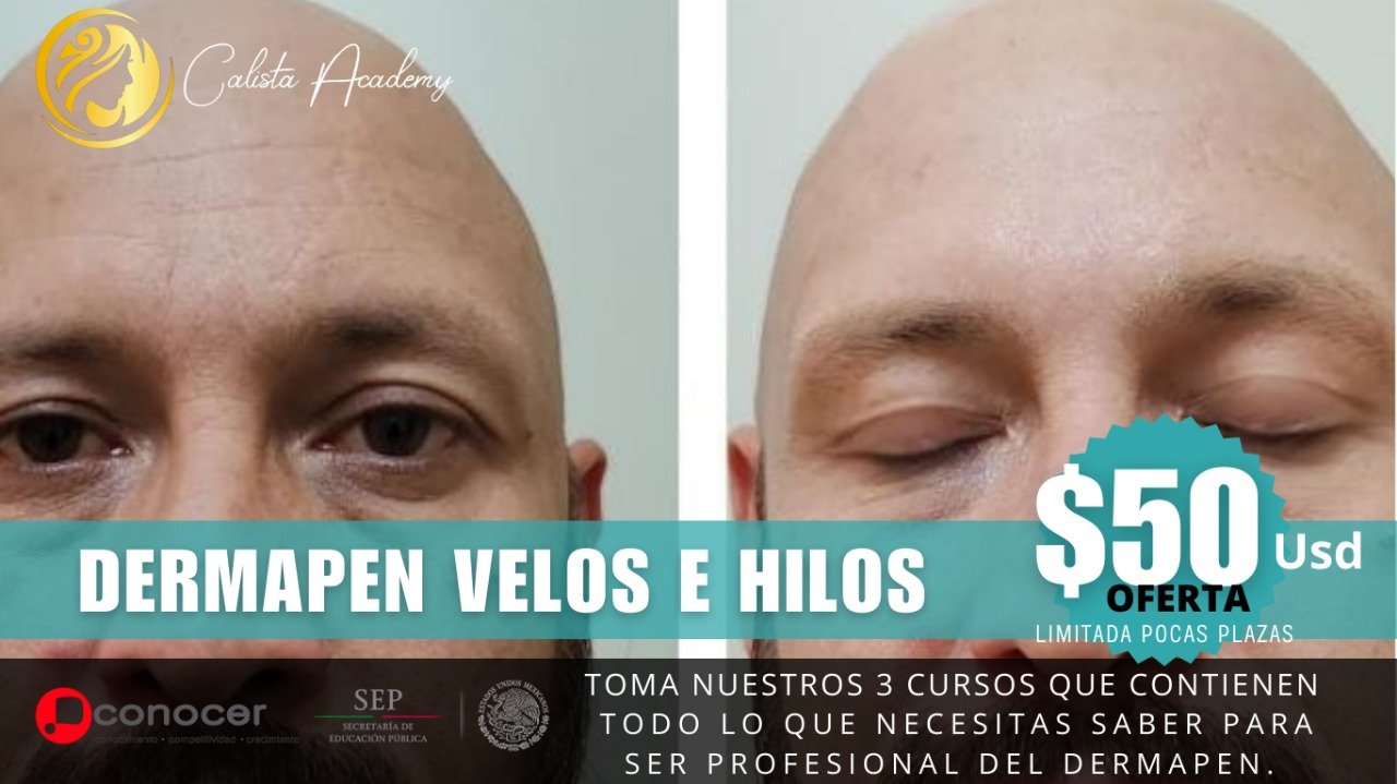 Dermapen Velos e Hilos de Colágeno